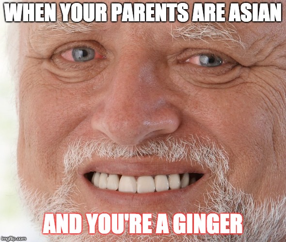 Asian Parents and Gingivitis | WHEN YOUR PARENTS ARE ASIAN; AND YOU'RE A GINGER | image tagged in hide the pain harold,ginger,memes,asian | made w/ Imgflip meme maker