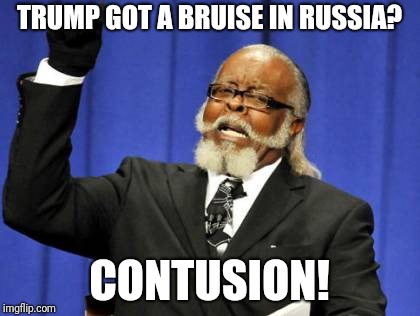 AHAHAHAHAHAHAHA | TRUMP GOT A BRUISE IN RUSSIA? CONTUSION! | image tagged in memes,too damn high,collusion,trump,ilikepie314159265358979 | made w/ Imgflip meme maker