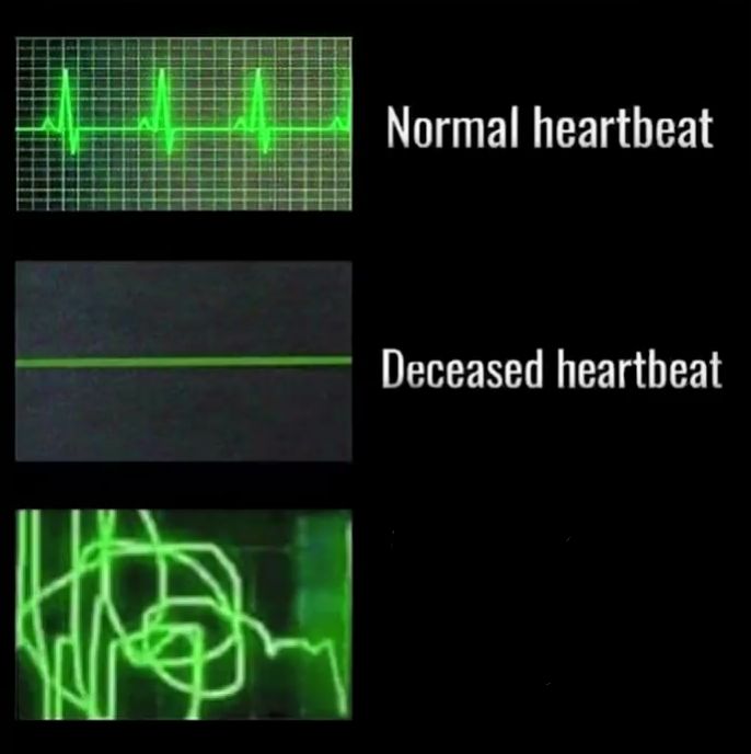 Heartbeat Blank Meme Template