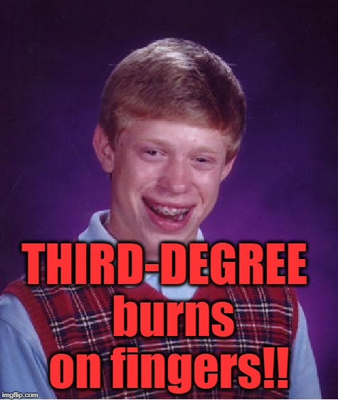 Bad Luck Brian Meme | THIRD-DEGREE  burns on fingers!! | image tagged in memes,bad luck brian | made w/ Imgflip meme maker