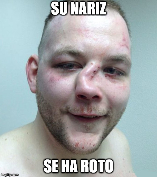 Broken Nose | SU NARIZ; SE HA ROTO | image tagged in broken nose | made w/ Imgflip meme maker
