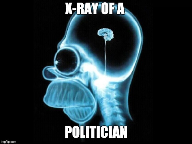 X-RAY OF A; POLITICIAN | image tagged in xray | made w/ Imgflip meme maker