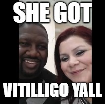 phil the advise show | SHE GOT; VITILLIGO YALL | image tagged in black and white | made w/ Imgflip meme maker