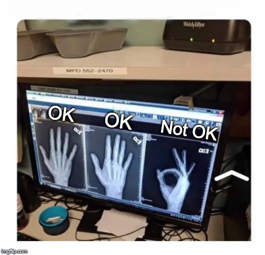 X-ray for broken pinky | OK; OK; Not OK | image tagged in x-ray,okay,power,fingers,pinky | made w/ Imgflip meme maker