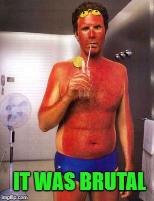 sunburn | IT WAS BRUTAL | image tagged in sunburn | made w/ Imgflip meme maker