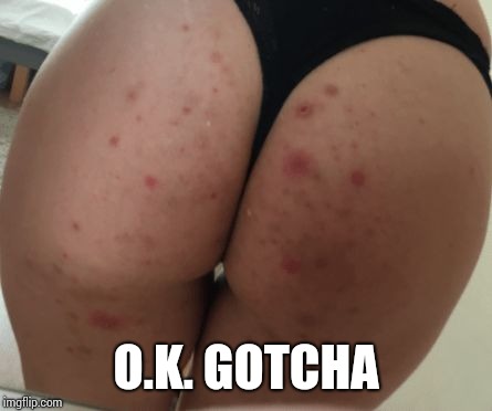 Ass rash | O.K. GOTCHA | image tagged in ass rash | made w/ Imgflip meme maker