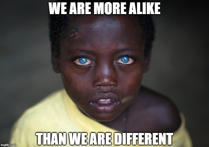 What Have We Become | WE ARE MORE ALIKE; THAN WE ARE DIFFERENT | image tagged in memes | made w/ Imgflip meme maker