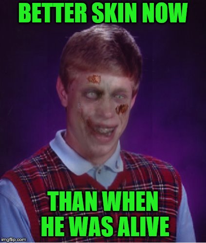 Zombie Bad Luck Brian Meme | BETTER SKIN NOW THAN WHEN HE WAS ALIVE | image tagged in memes,zombie bad luck brian | made w/ Imgflip meme maker