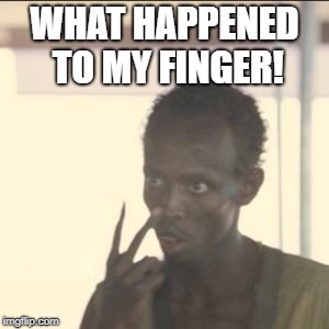 what | WHAT HAPPENED TO MY FINGER! | image tagged in memes,look at me | made w/ Imgflip meme maker