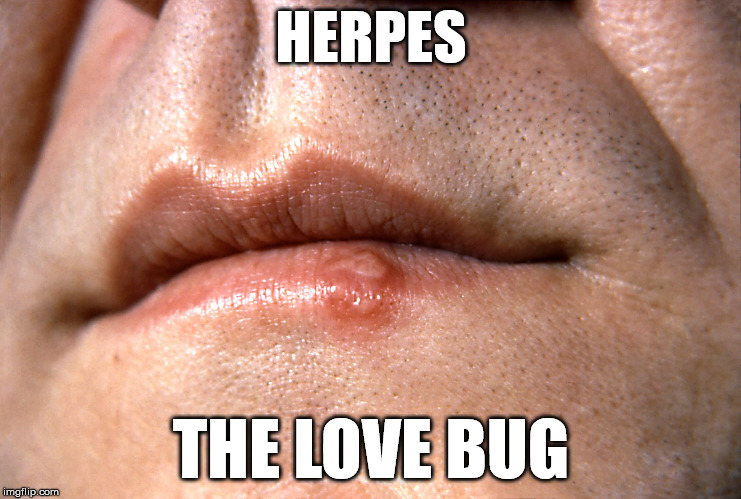 Was just thinking about Herbie. My mind wanders. | HERPES; THE LOVE BUG | image tagged in stds,memes | made w/ Imgflip meme maker
