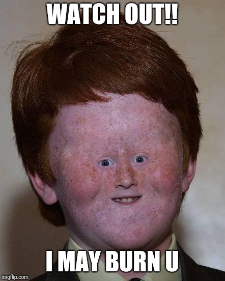 Dumb Ginger | WATCH OUT!! I MAY BURN U | image tagged in dumb ginger | made w/ Imgflip meme maker
