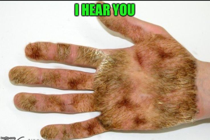 hairy palm | I HEAR YOU | image tagged in hairy palm | made w/ Imgflip meme maker