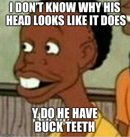 Hol up | I DON’T KNOW WHY HIS HEAD LOOKS LIKE IT DOES; Y DO HE HAVE BUCK TEETH | image tagged in hol up | made w/ Imgflip meme maker