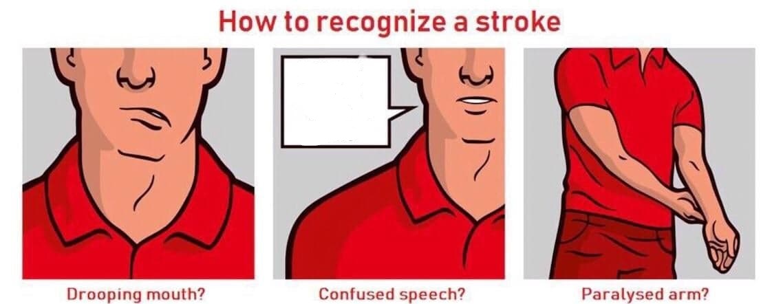 How to recognize a stroke Memes - Imgflip.