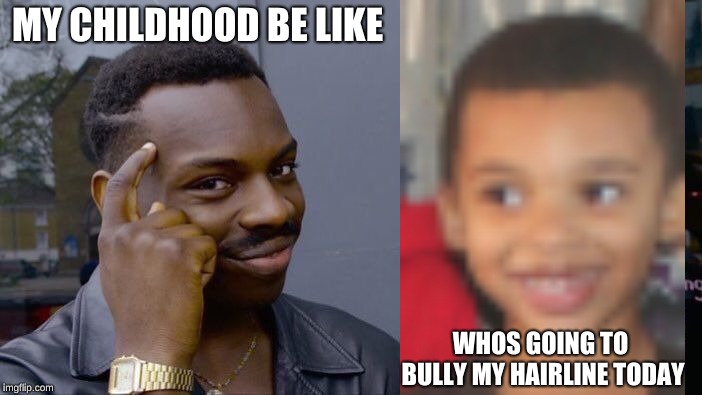 Roll Safe Think About It Meme | MY CHILDHOOD BE LIKE; WHOS GOING TO BULLY MY HAIRLINE TODAY | image tagged in memes,roll safe think about it | made w/ Imgflip meme maker