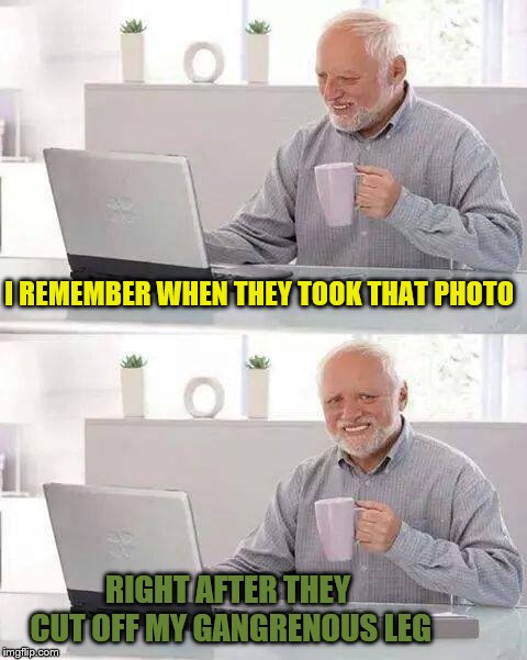 Hide the Pain Harold Meme | I REMEMBER WHEN THEY TOOK THAT PHOTO RIGHT AFTER THEY CUT OFF MY GANGRENOUS LEG | image tagged in memes,hide the pain harold | made w/ Imgflip meme maker