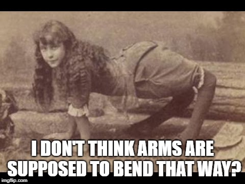 Backward Legs | I DON'T THINK ARMS ARE SUPPOSED TO BEND THAT WAY? | image tagged in backward legs | made w/ Imgflip meme maker