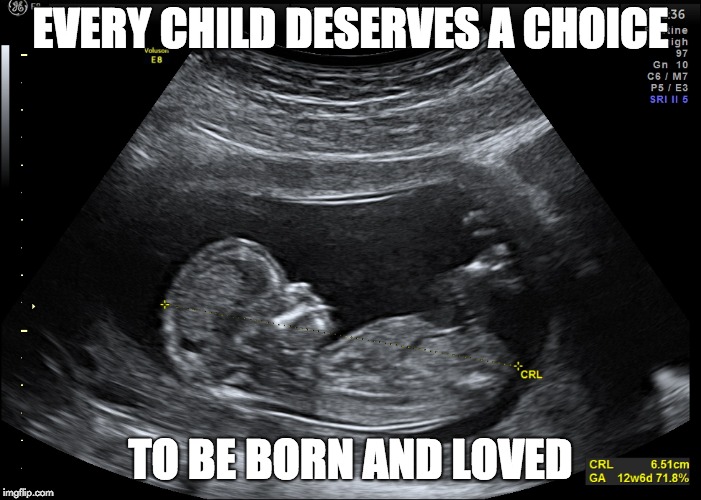 Pro-Lifechoice | EVERY CHILD DESERVES A CHOICE; TO BE BORN AND LOVED | image tagged in prolife,prochoice,chooselife,prolove,birthchoice,humanity | made w/ Imgflip meme maker