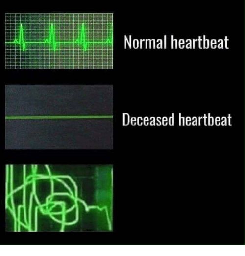 normal heartbeat deceased heartbeat Blank Meme Template