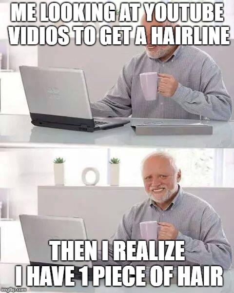 Hide the Pain Harold Meme | ME LOOKING AT YOUTUBE VIDIOS TO GET A HAIRLINE; THEN I REALIZE I HAVE 1 PIECE OF HAIR | image tagged in memes,hide the pain harold | made w/ Imgflip meme maker