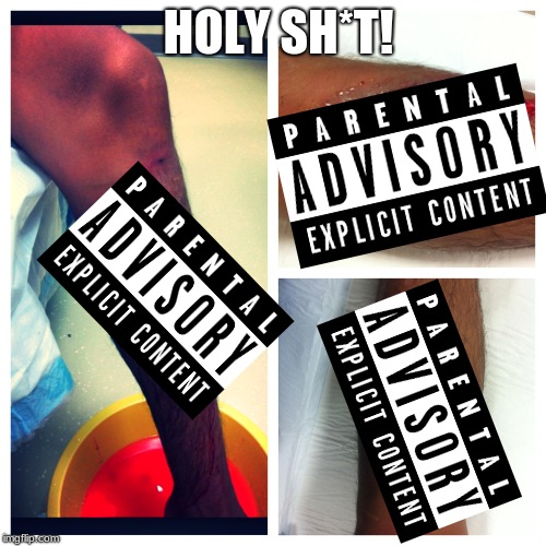 WTF HAPPENED?? censored version this is a child friendly website. | HOLY SH*T! | image tagged in ouch,censored | made w/ Imgflip meme maker