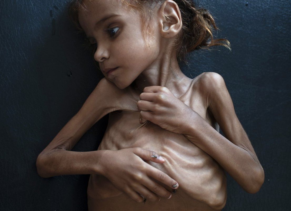 Yemeni Famine Blank Meme Template