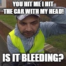 Why you coming fast. | YOU HIT ME I HIT THE CAR WITH MY HEAD! IS IT BLEEDING? | image tagged in funny | made w/ Imgflip meme maker
