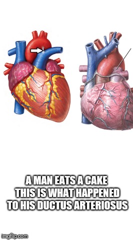 Starter Pack | A MAN EATS A CAKE THIS IS WHAT HAPPENED TO HIS DUCTUS ARTERIOSUS | image tagged in starter pack | made w/ Imgflip meme maker