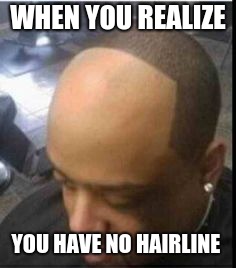 Hairline Pushback | WHEN YOU REALIZE; YOU HAVE NO HAIRLINE | image tagged in hairline pushback | made w/ Imgflip meme maker