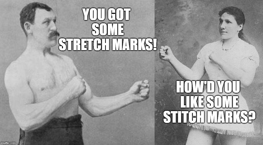 YOU GOT SOME STRETCH MARKS! HOW'D YOU LIKE SOME STITCH MARKS? | image tagged in overly manly man,overly manly woman | made w/ Imgflip meme maker