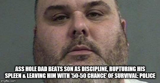 child beater | ASS HOLE DAD BEATS SON AS DISCIPLINE, RUPTURING HIS SPLEEN & LEAVING HIM WITH ’50-50 CHANCE’ OF SURVIVAL: POLICE | image tagged in beater,hate,meme,memes,child beater,child abuse | made w/ Imgflip meme maker
