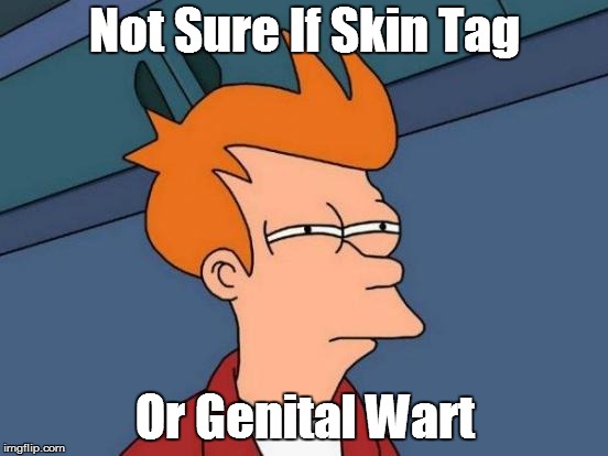 Futurama Fry Meme | Not Sure If Skin Tag; Or Genital Wart | image tagged in memes,futurama fry | made w/ Imgflip meme maker