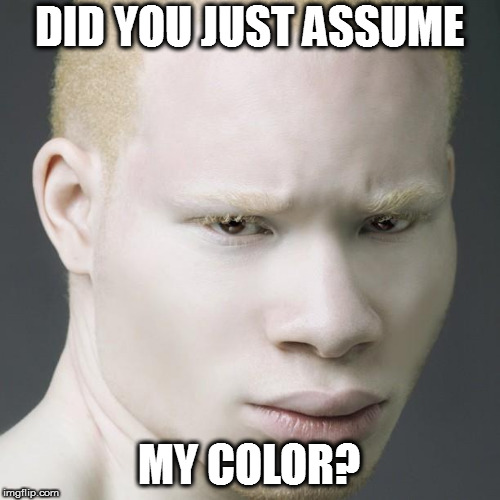 A3 (Albino African American) | DID YOU JUST ASSUME MY COLOR? | image tagged in a3 albino african american | made w/ Imgflip meme maker