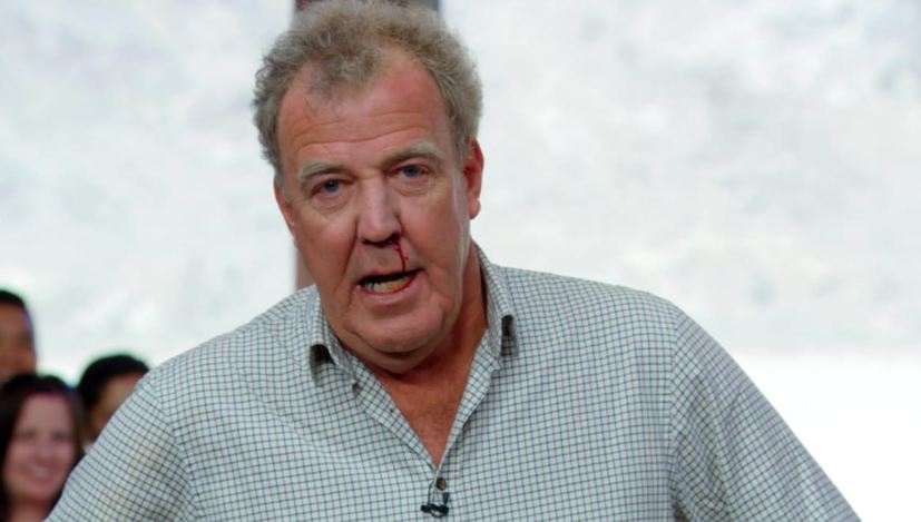 High Quality Jeremy Clarkson Bloody nose Blank Meme Template