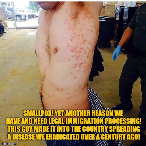 SMALLPOX! YET ANOTHER REASON WE HAVE AND NEED LEGAL IMMIGRATION PROCESSING! THIS GUY MADE IT INTO THE COUNTRY SPREADING A DISEASE WE ERADICA | made w/ Imgflip meme maker