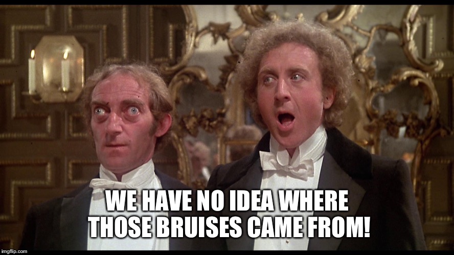 WE HAVE NO IDEA WHERE THOSE BRUISES CAME FROM! | made w/ Imgflip meme maker