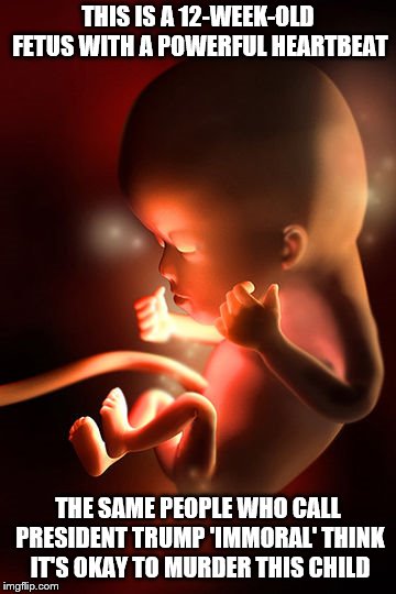 Abortion is Murder | THIS IS A 12-WEEK-OLD FETUS WITH A POWERFUL HEARTBEAT; THE SAME PEOPLE WHO CALL PRESIDENT TRUMP 'IMMORAL' THINK IT'S OKAY TO MURDER THIS CHILD | image tagged in abortion,fetus,liberals | made w/ Imgflip meme maker