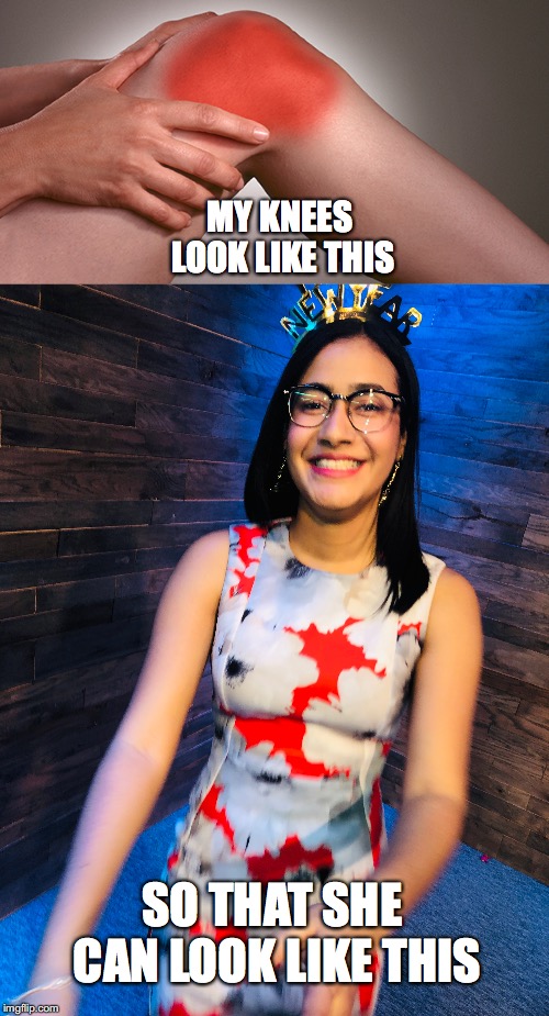 MY KNEES LOOK LIKE THIS; SO THAT SHE CAN LOOK LIKE THIS | image tagged in my,knees,look,like,this,so | made w/ Imgflip meme maker