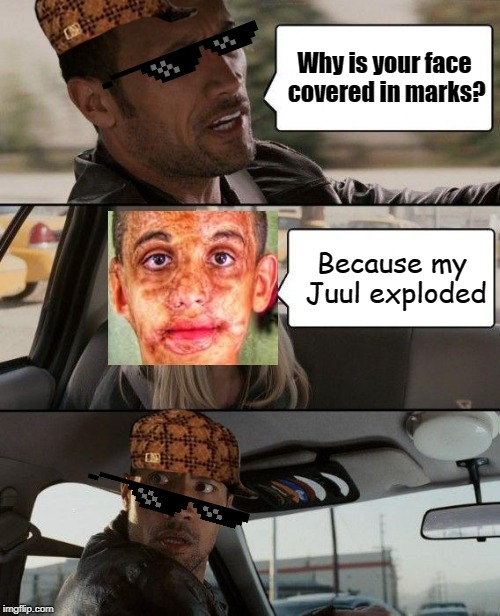 The Rock Driving Meme | Why is your face covered in marks? Because my Juul exploded | image tagged in memes,the rock driving | made w/ Imgflip meme maker