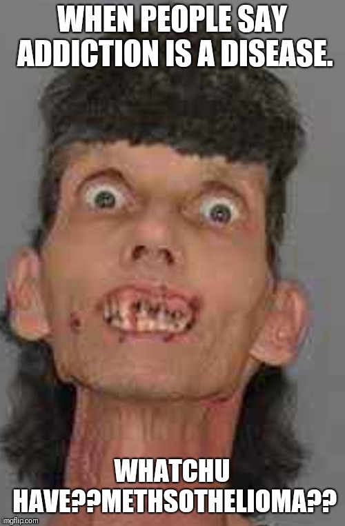 Methed up | WHEN PEOPLE SAY ADDICTION IS A DISEASE. WHATCHU HAVE??METHSOTHELIOMA?? | image tagged in funny | made w/ Imgflip meme maker