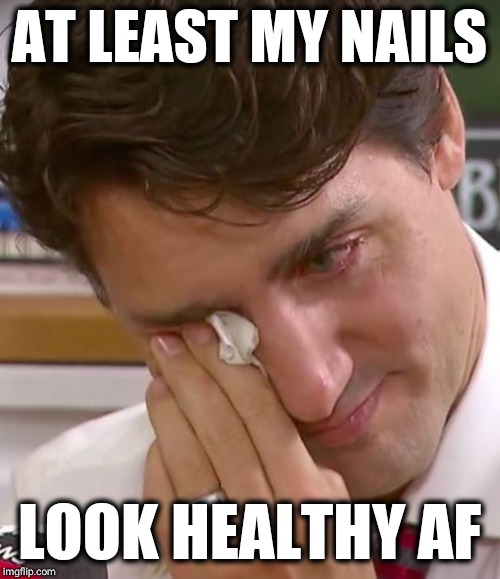 Justin Trudeau Crying | AT LEAST MY NAILS; LOOK HEALTHY AF | image tagged in justin trudeau crying | made w/ Imgflip meme maker