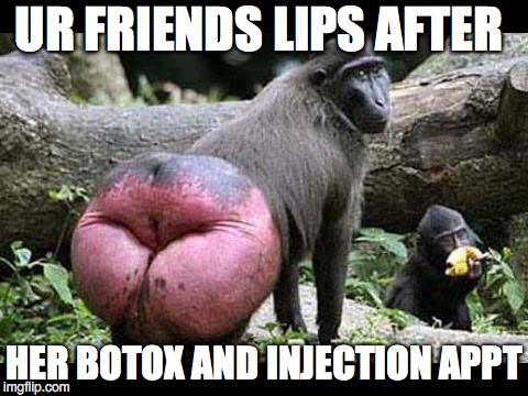 baboon | UR FRIENDS LIPS AFTER; HER BOTOX AND INJECTION APPT | image tagged in baboon | made w/ Imgflip meme maker