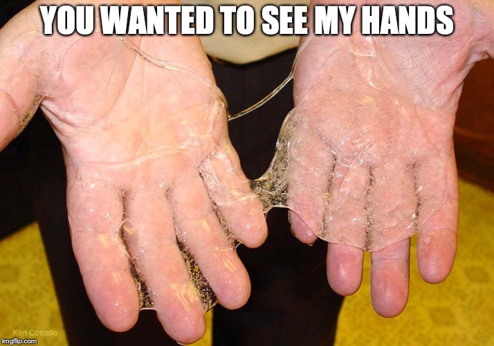 Sticky hands | YOU WANTED TO SEE MY HANDS | image tagged in sticky hands | made w/ Imgflip meme maker