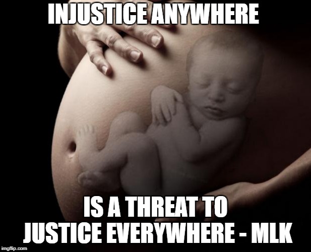 Pregnant Stomach | INJUSTICE ANYWHERE; IS A THREAT TO JUSTICE EVERYWHERE - MLK | image tagged in pregnant stomach | made w/ Imgflip meme maker