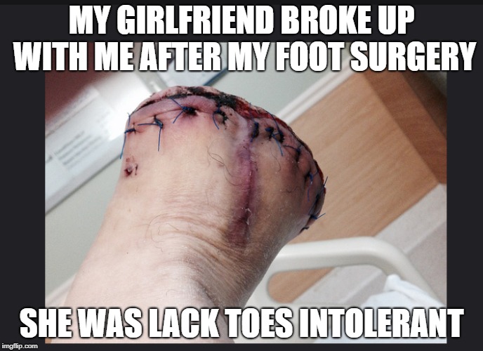 Lack Toes Intolerant | MY GIRLFRIEND BROKE UP WITH ME AFTER MY FOOT SURGERY; SHE WAS LACK TOES INTOLERANT | image tagged in foot surgery,amputation,girlfriend | made w/ Imgflip meme maker