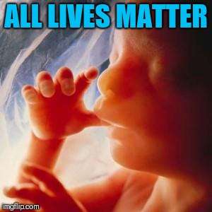 Fetus | ALL LIVES MATTER | image tagged in fetus | made w/ Imgflip meme maker