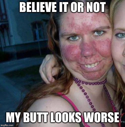 Red face | BELIEVE IT OR NOT MY BUTT LOOKS WORSE | image tagged in red face | made w/ Imgflip meme maker