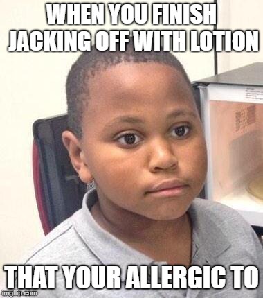 Minor Mistake Marvin Meme | WHEN YOU FINISH JACKING OFF WITH LOTION; THAT YOUR ALLERGIC TO | image tagged in memes,minor mistake marvin | made w/ Imgflip meme maker
