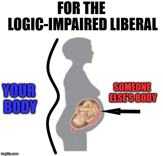 Different DNA, different fingerprints, different person. | FOR THE LOGIC-IMPAIRED LIBERAL; SOMEONE ELSE'S BODY; YOUR BODY | image tagged in pregnant woman | made w/ Imgflip meme maker