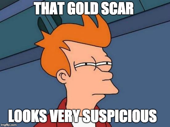 Futurama Fry | THAT GOLD SCAR; LOOKS VERY SUSPICIOUS | image tagged in memes,futurama fry | made w/ Imgflip meme maker